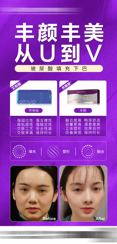 玻尿酸案例推广海报_源文件下载_PSD格式_1000X2072像素-固定,面部,填充-作品编号:2025031509143089-志设-zs9.com