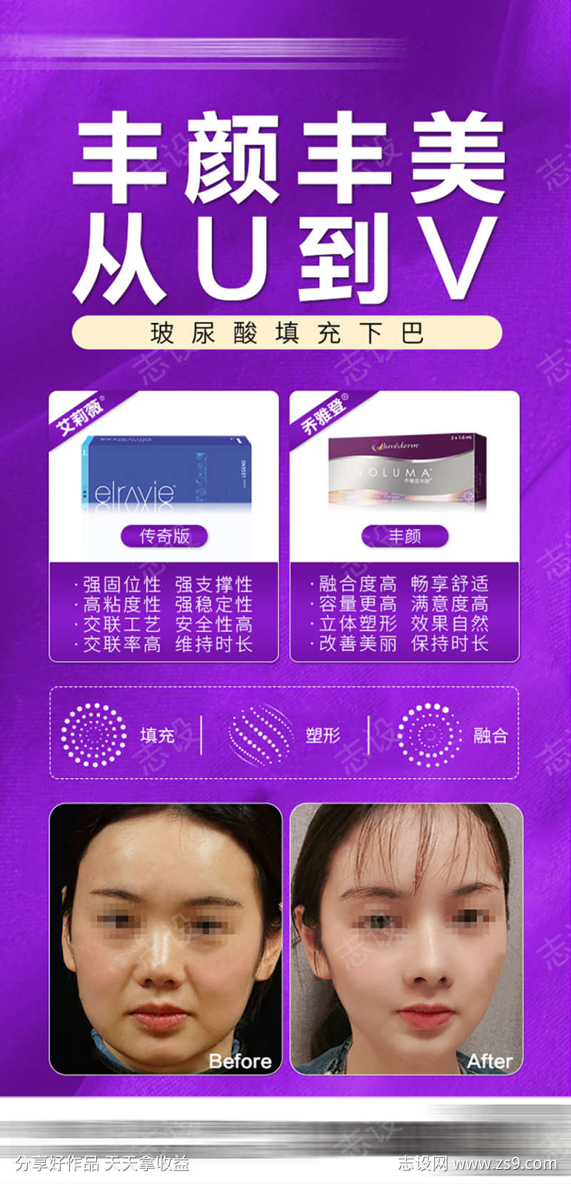 玻尿酸案例推广海报