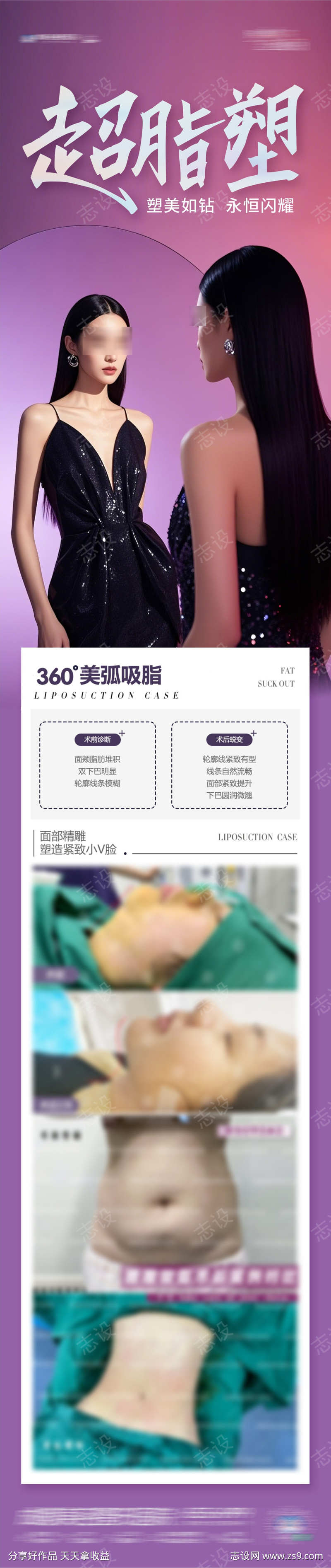 医美超脂塑吸脂塑形案例创意海报