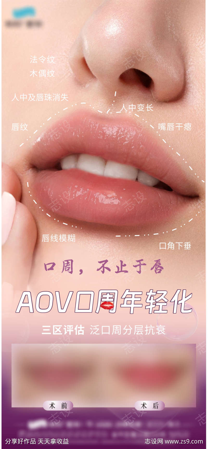 AOV口周年轻化
