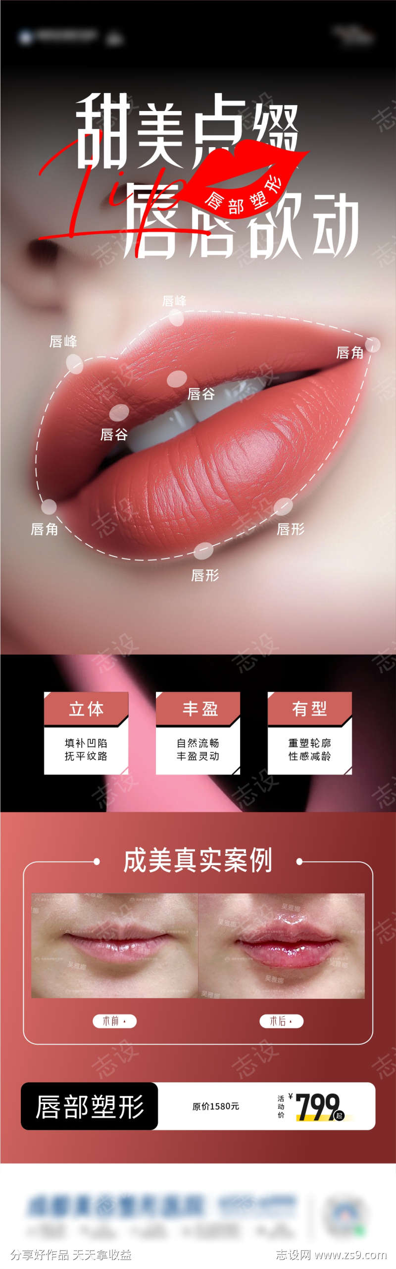 唇部整形海报