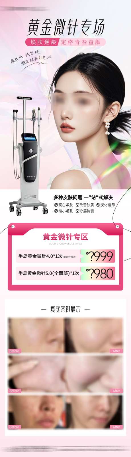 医美黄金微针项目专场活动_源文件下载_PSD格式_1080X3762像素-专场活动,项目卡项,黄金微针-作品编号:2025032515228745-志͵设·网