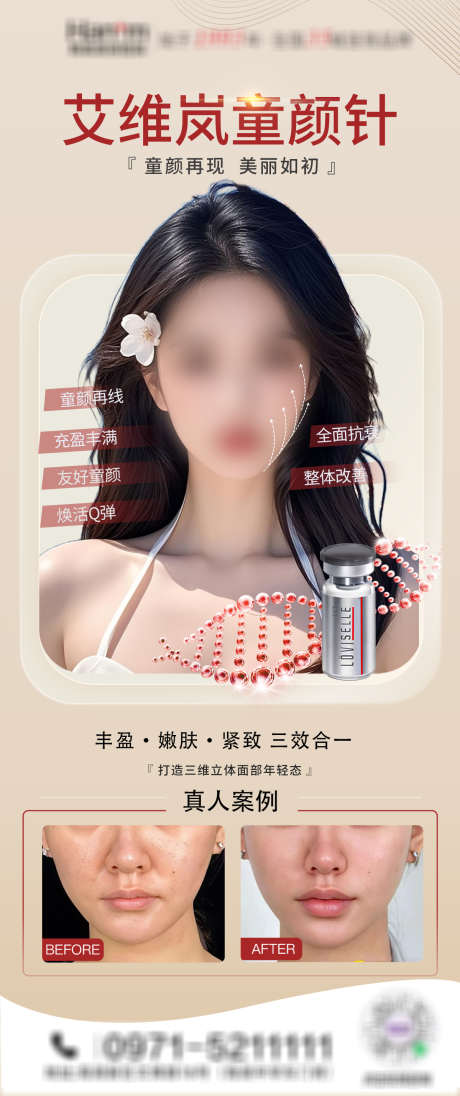 医美艾维岚童颜针_源文件下载_PSD格式_1200X2860像素-红色,海报,童颜针-作品编号:2025032609033744-志˯设′网