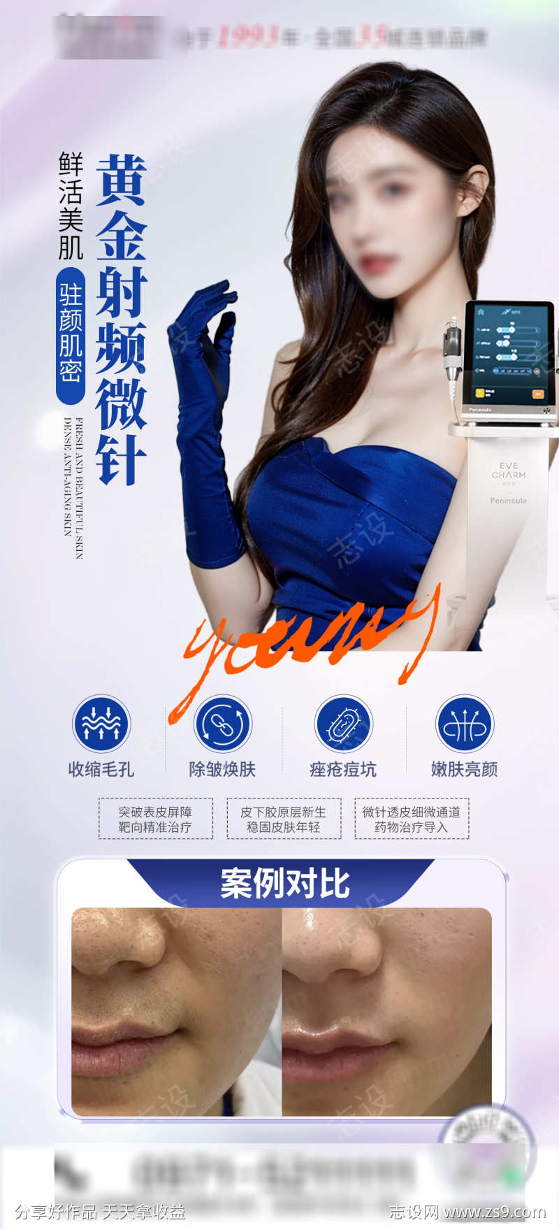 医美黄金射频微针