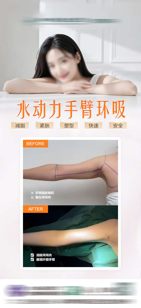 水动力手臂吸脂_源文件下载_PSD格式_1080X2350像素-换吸,手臂,手动力-作品编号:2025032614335194-志设-zs9.com