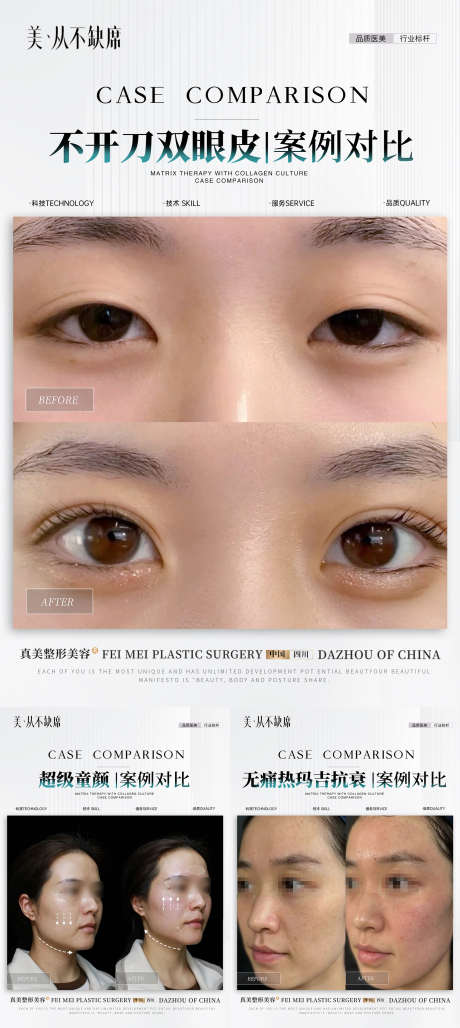 医美简约案例_源文件下载_PSD格式_2000X4470像素-简约,丰唇,玻尿酸-作品编号:2025032610566202-志设-zs9.com