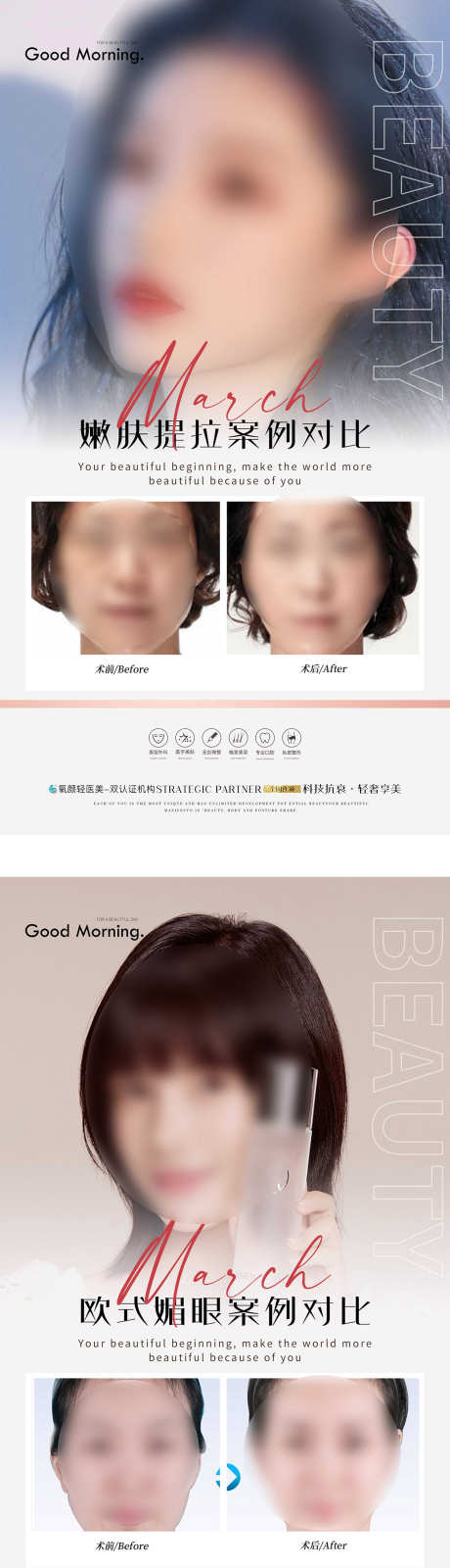 医美案例对比_源文件下载_PSD格式_1260X9686像素-对比,案例,微调-作品编号:2025033013487083-志设-zs9.com