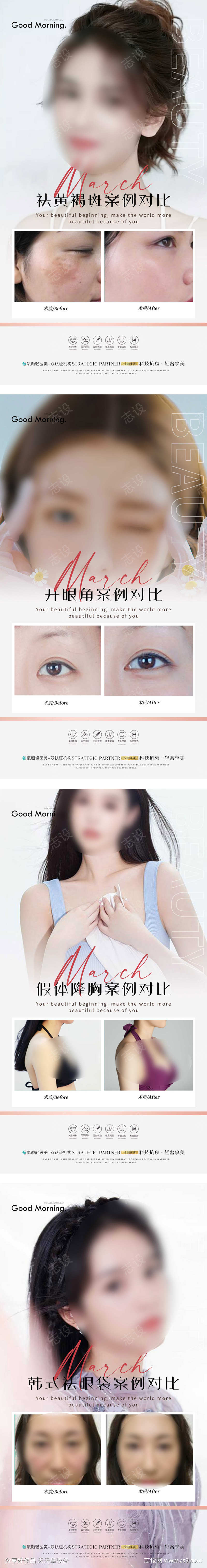 医美案例对比