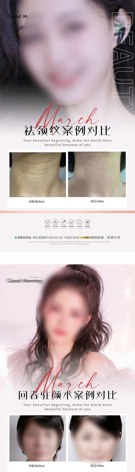 颈纹案例对比_源文件下载_PSD格式_1456X5534像素-前后,对比,案例-作品编号:2025033013437079-志设-zs9.com
