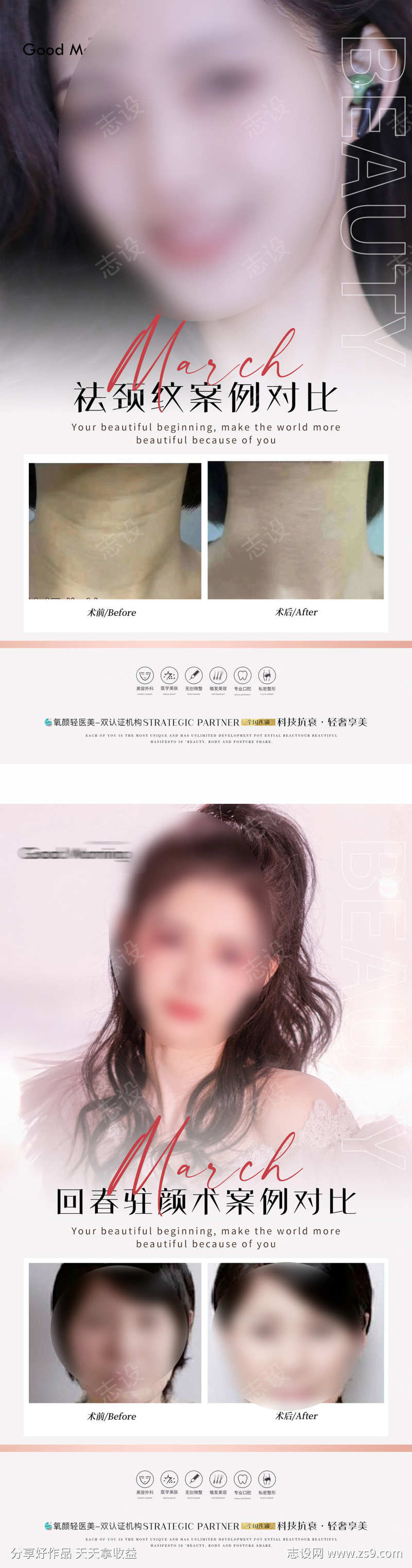 颈纹案例对比