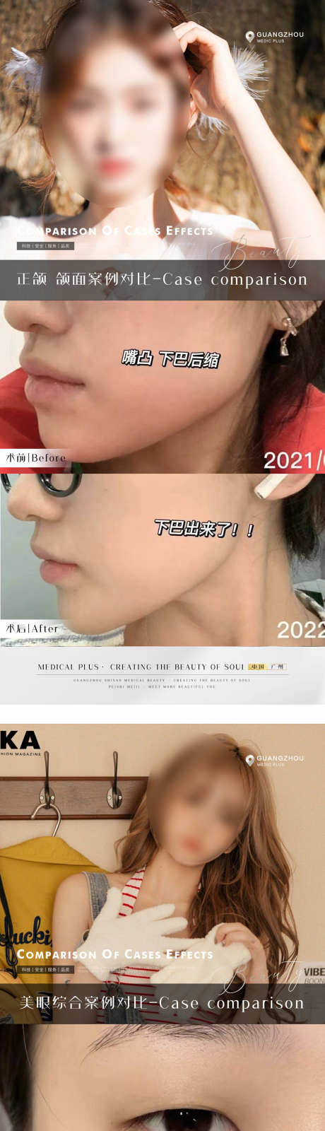 医美案例对比_源文件下载_PSD格式_1102X9745像素-对比,案例,微调-作品编号:2025033013354422-志设-zs9.com