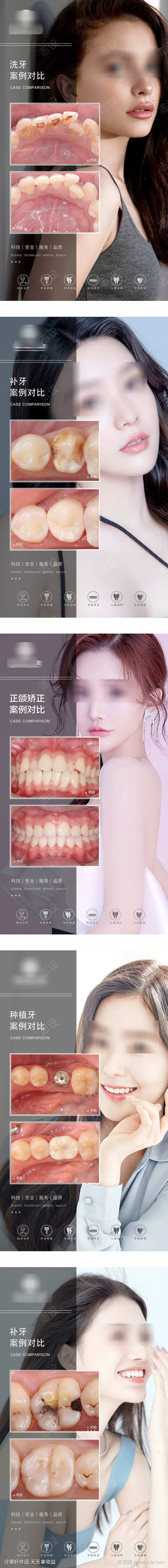 矫正案例对比