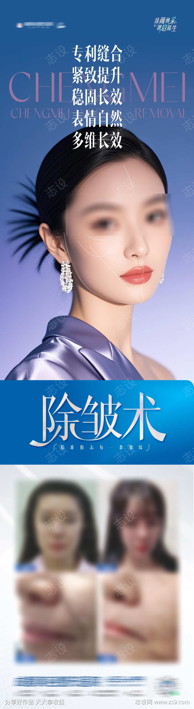 医美除皱术案例长图创意海报