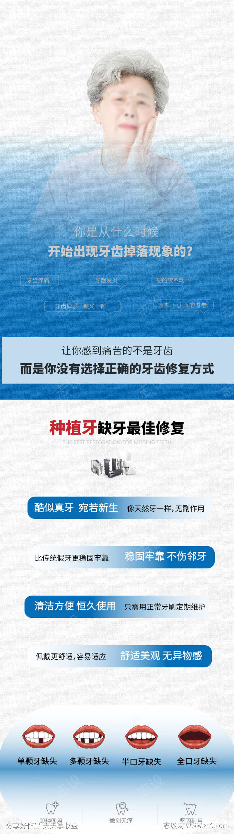 口腔医院种植牙优势品宣海报