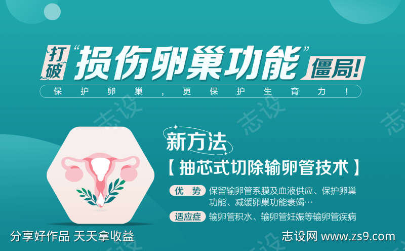 切除输卵管技术