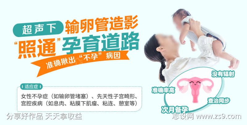 输卵管造影