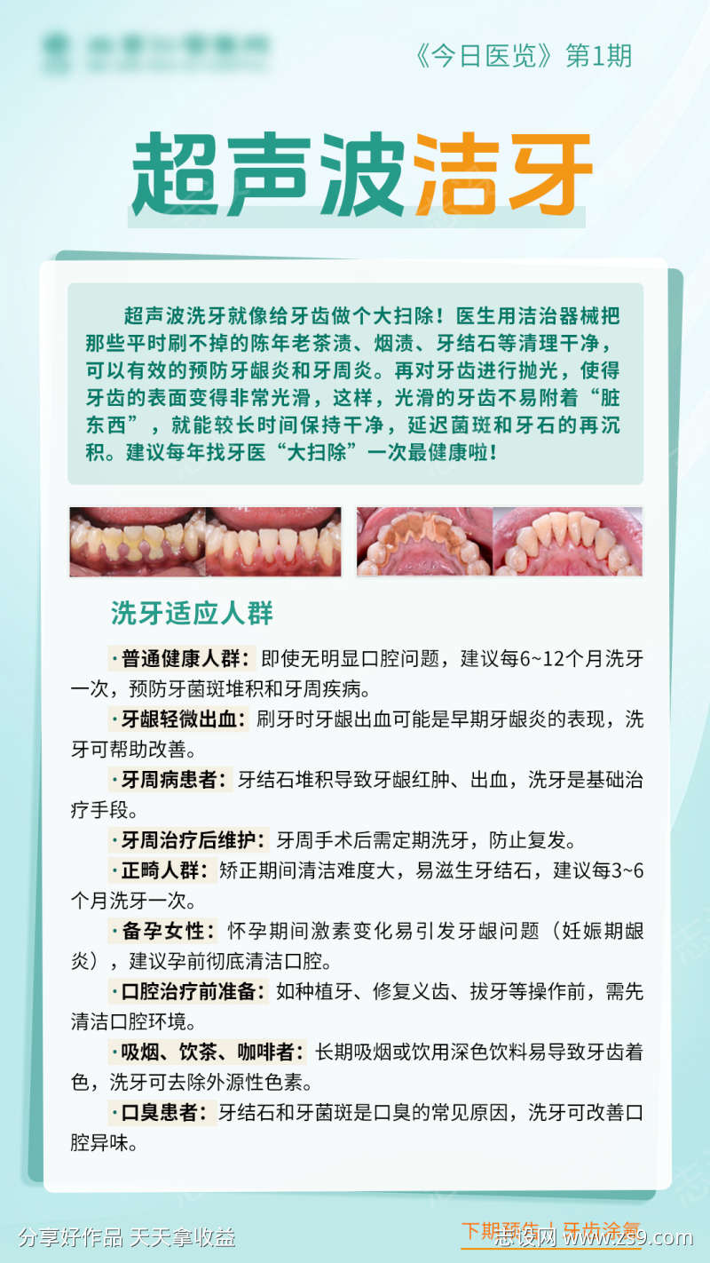超声波洁牙科普