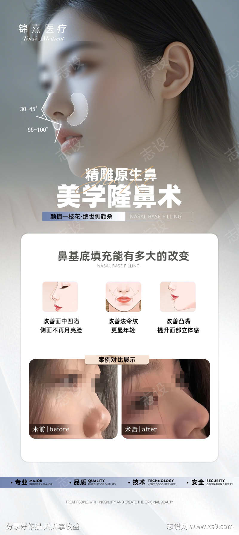 医美海报科普