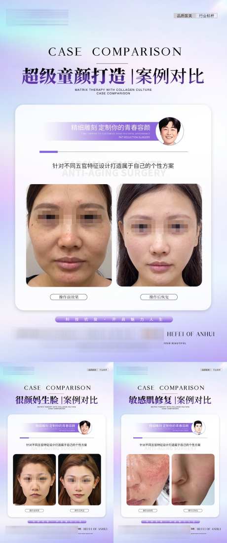医美紫色案例_源文件下载_PSD格式_1080X2583像素-修复,童颜,幼态脸-作品编号:2025041613447435-志设-zs9.com
