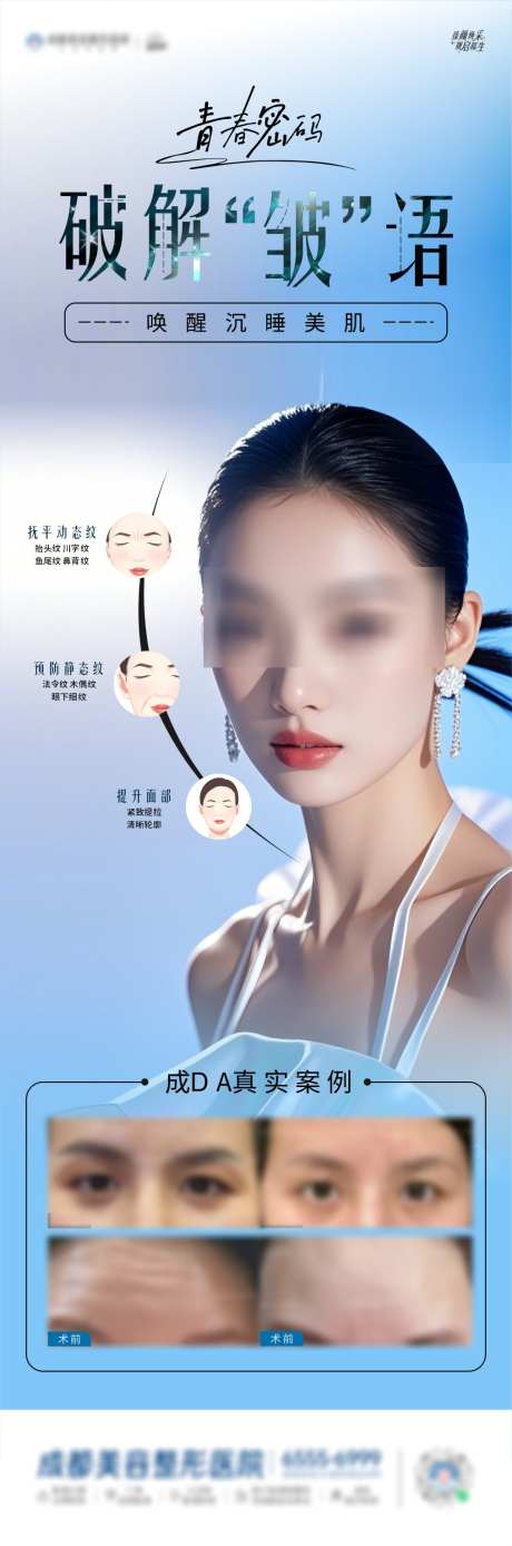 肉毒素除皱海报_源文件下载_CDR格式_1014X3059像素-长图,人物,医美-作品编号:2025041613515935-志设-zs9.com