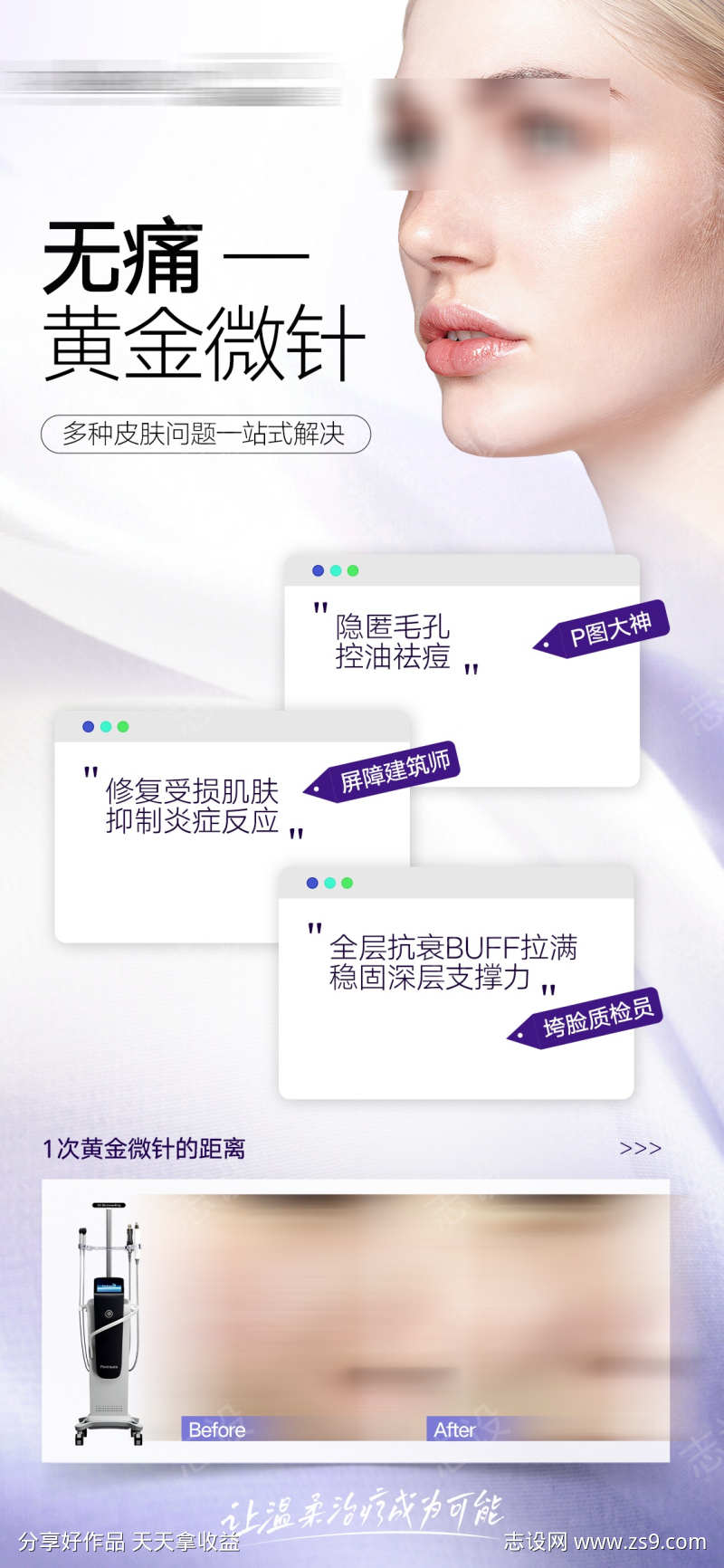 无痛黄金微针