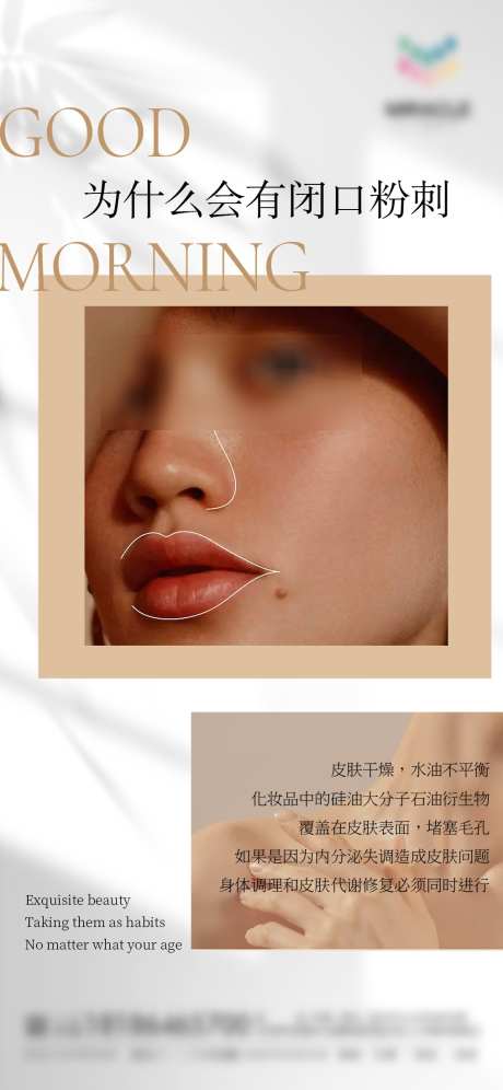 为什么会有闭口粉刺_源文件下载_PSD格式_1016X2200像素-科普,皮肤,管理-作品编号:2025041917207979-志设-zs9.com