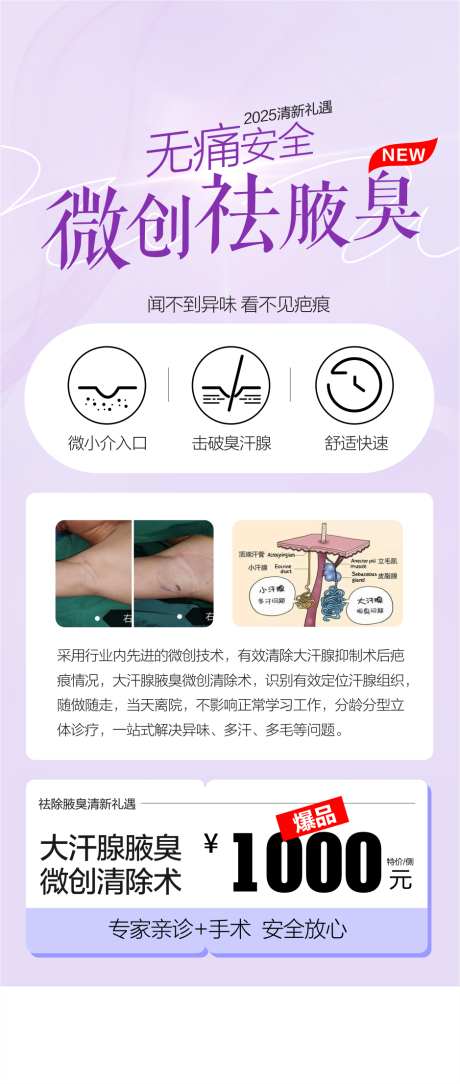 医美除腋臭海报_源文件下载_CDR格式_159X344像素-海报,微创,除臭-作品编号:2025042308504431-志设-zs9.com