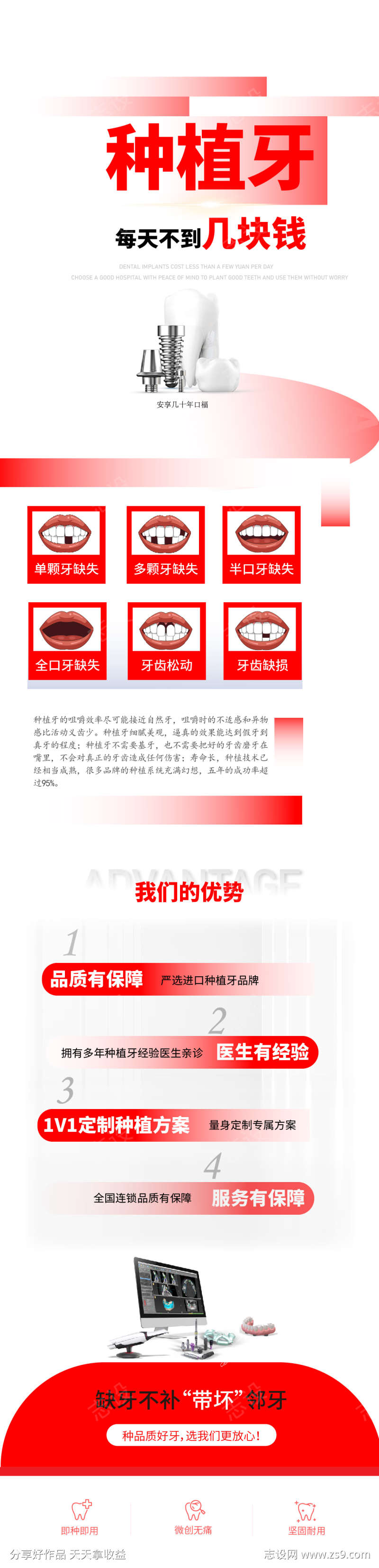 口腔种植牙品宣海报1
