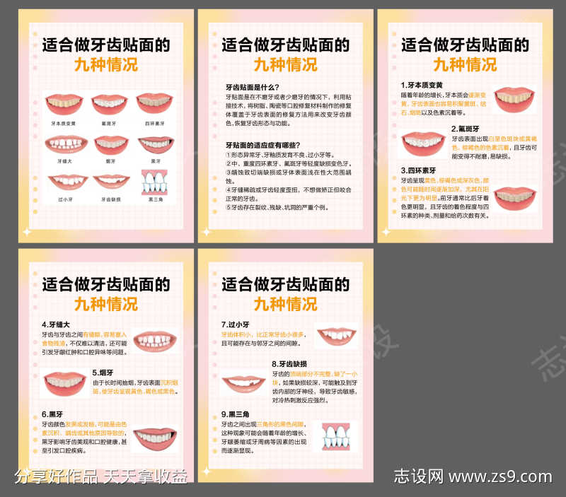 牙齿贴面小红书口腔科普