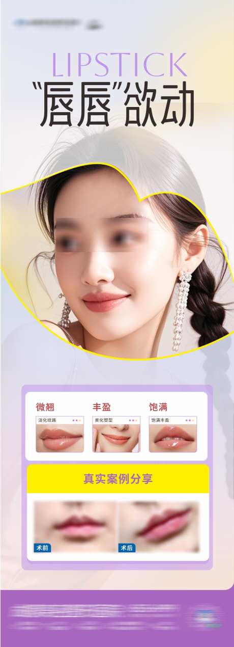 医美唇部塑形案例创意海报_源文件下载_CDR格式_1284X3544像素-简洁,清新,丰盈-作品编号:2025050513523889-志设-zs9.com