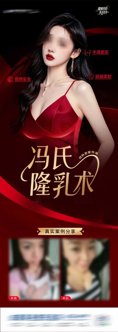 医美隆乳术案例创意长图海报_源文件下载_PSD格式_1284X3610像素-美胸,丰胸,案例-作品编号:2025050813491574-志设-zs9.com