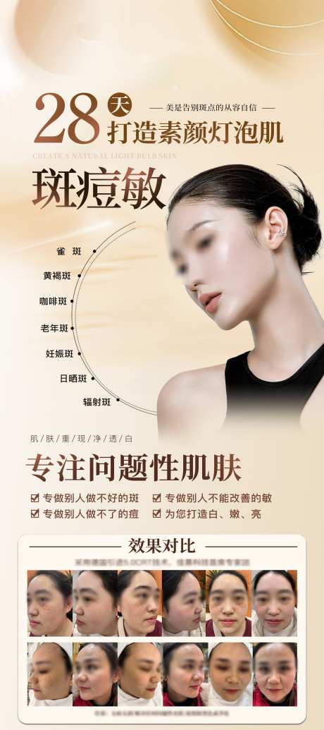 祛斑痘肌问题肌海报易拉宝_源文件下载_PSD格式_2268X5102像素-对比图,痘肌,易拉宝-作品编号:2025051708379814-志设-zs9.com