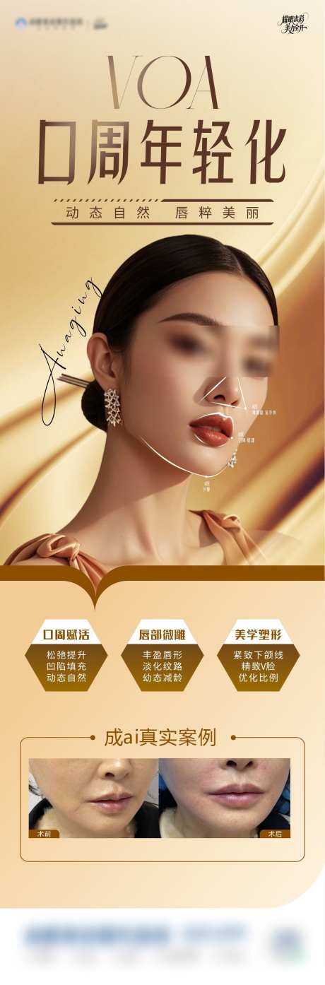 voa口周年轻化_源文件下载_CDR格式_1182X3582像素-鼻基底,法令纹,抗衰-作品编号:2025052508343823-志设-zs9.com