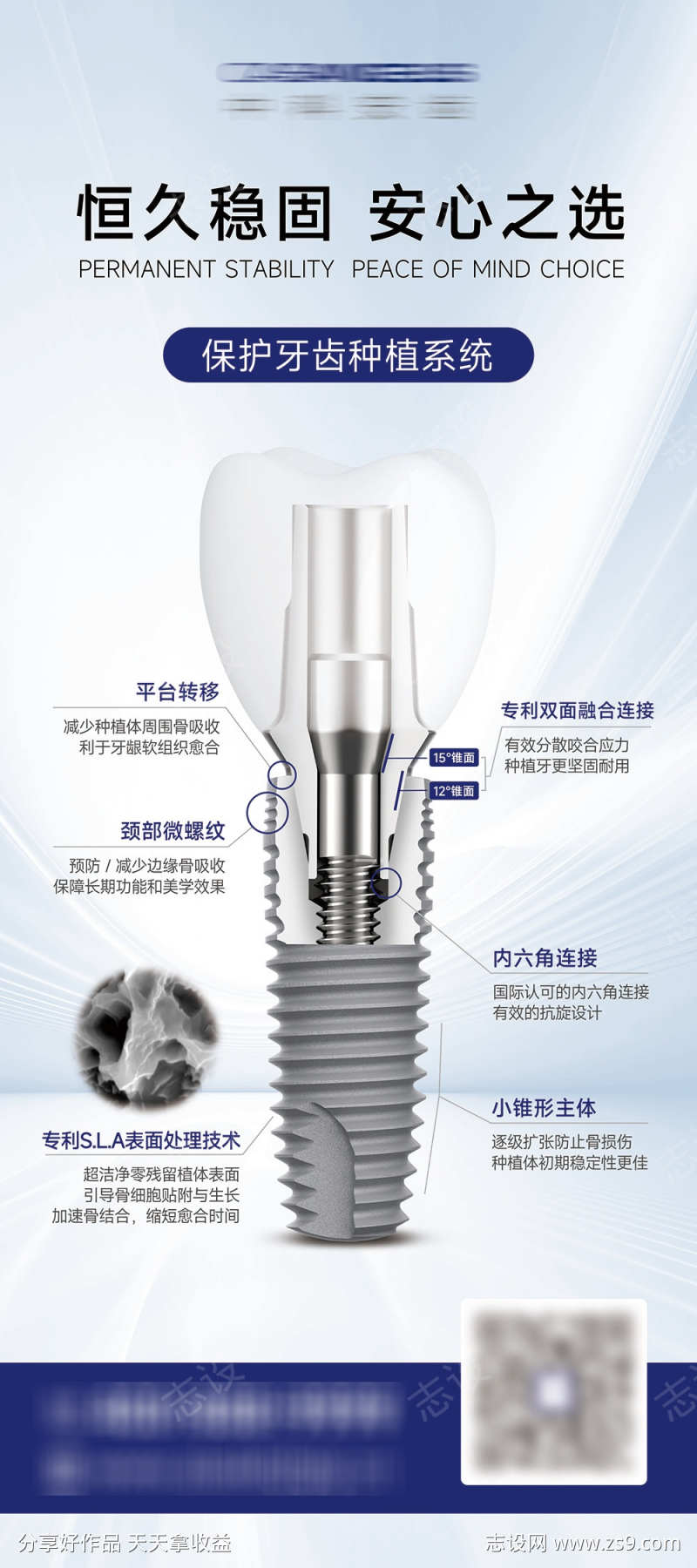 口腔种植牙植体介绍展架