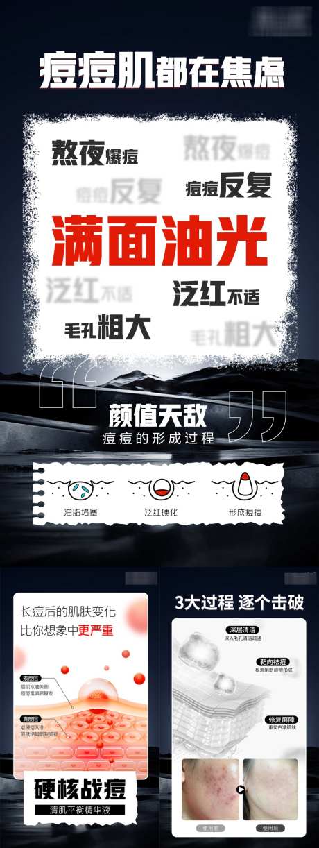 祛痘宣传系列海报_源文件下载_PSD格式_1080X2870像素-美容,医美,化妆品-作品编号:2025053011188695-志设-zs9.com