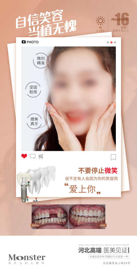 医美案例对比_源文件下载_PSD格式_2099X4150像素-案例,整形,整容-作品编号:2025062316325623-志设-zs9.com