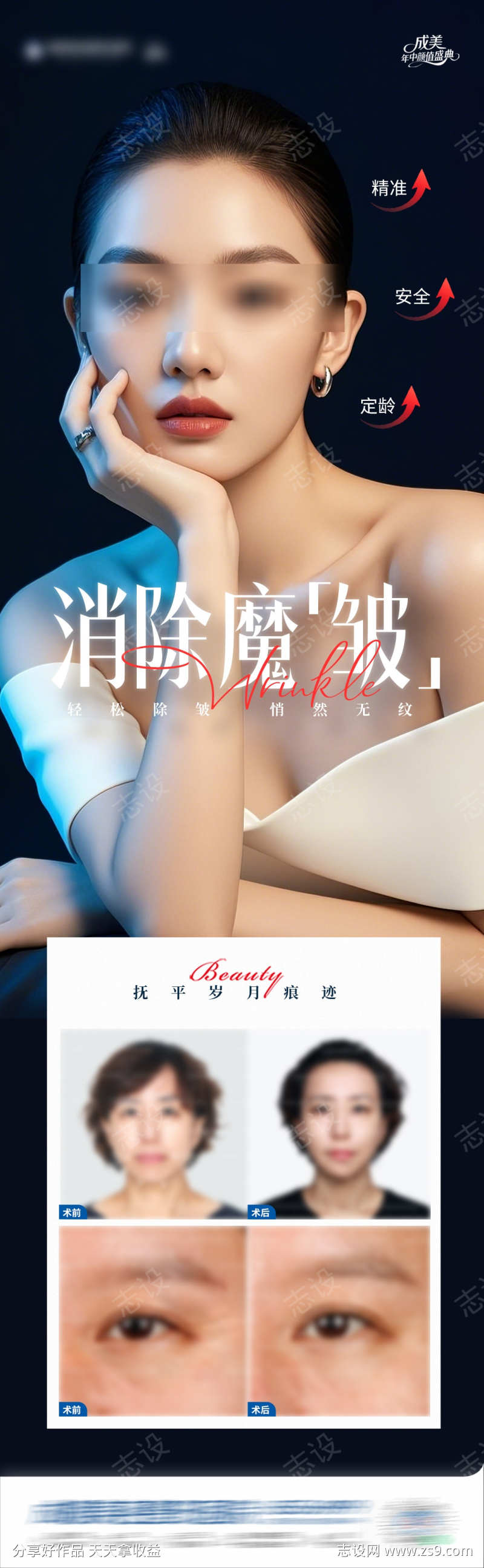 医美肉毒素除皱案例创意海报