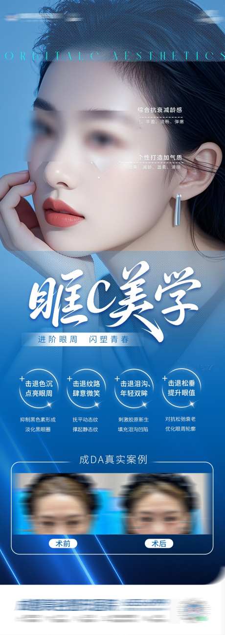 眶C眼部美学海报_源文件下载_PSD格式_1125X3173像素-美学,眶c,除皱-作品编号:2025060817161056-志设-zs9.com
