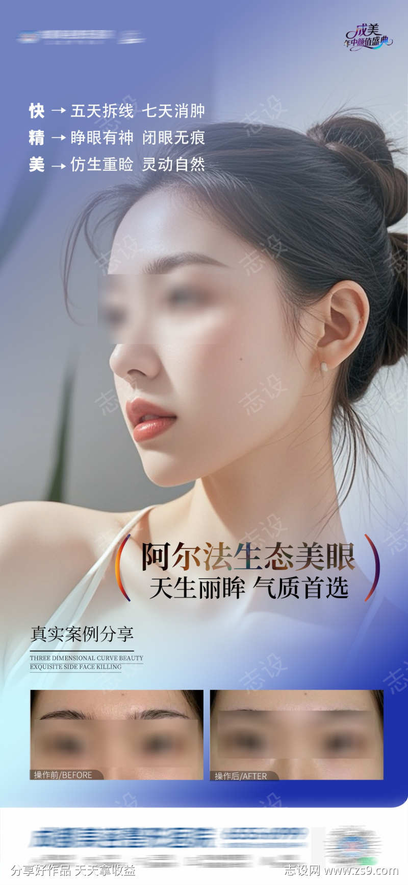 医美阿尔法生态美眼案例创意海报