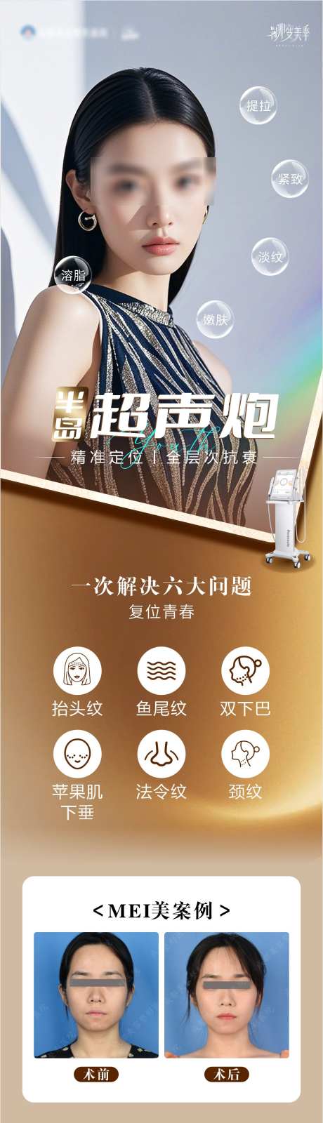 超声炮抗衰海报_源文件下载_CDR格式_1655X6212像素-紧致,活动,嫩肤-作品编号:2025060913077670-志设-zs9.com