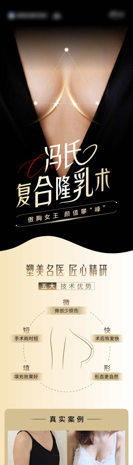 隆胸填充海报_源文件下载_CDR格式_1776X7085像素-胸部,立挺,双c曲线-作品编号:2025060913172573-志设