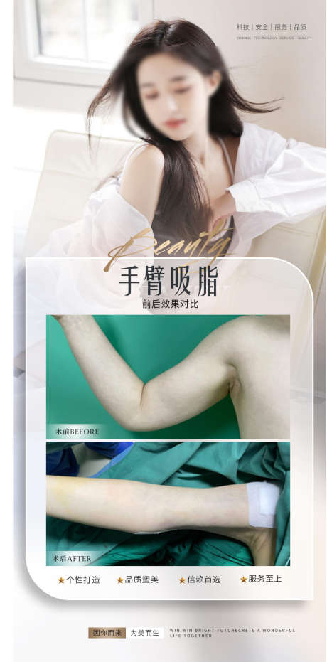 医美吸脂对比_源文件下载_PSD格式_1128X2284像素-对比,小常识,知识点-作品编号:2025070716432037-志设-zs9.com
