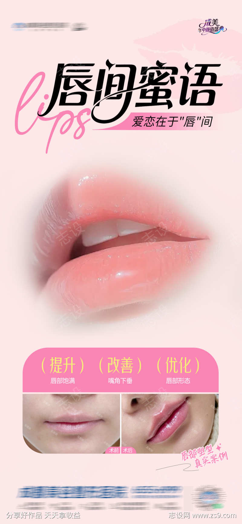 医美嘴唇唇部口周年轻化塑形案例海报