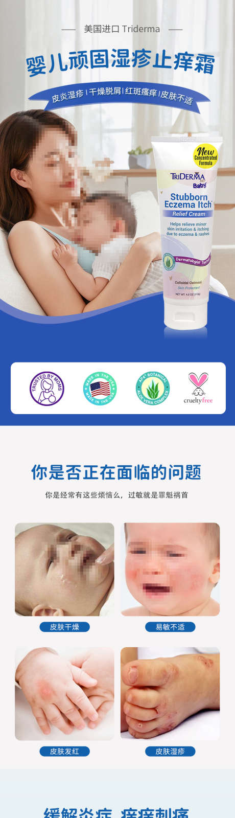 婴幼儿湿疹止痒霜详情页_源文件下载_PSD格式_790X11139像素-清爽,凝胶,湿疹-作品编号:2025061915587863-志设-zs9.com