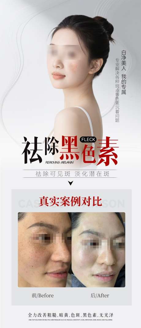 祛斑对比图_源文件下载_PSD格式_1152X2667像素-医美,简约,海报-作品编号:2025062016581561-志设-zs9.com