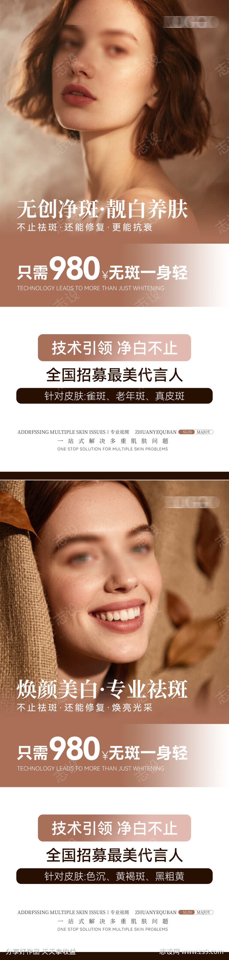 祛斑全国招募代言人