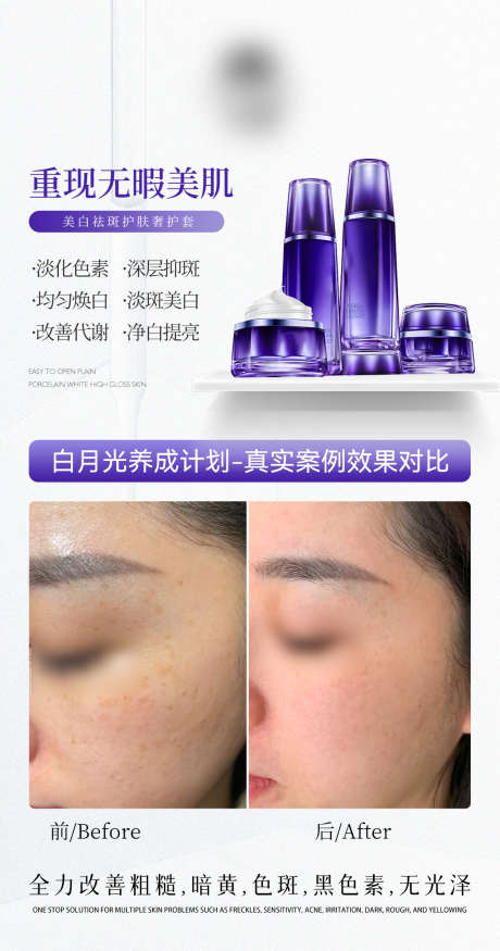 祛斑对比图_源文件下载_PSD格式_1125X2140像素-医美,对比图,产品-作品编号:2025062017003282-志设-zs9.com