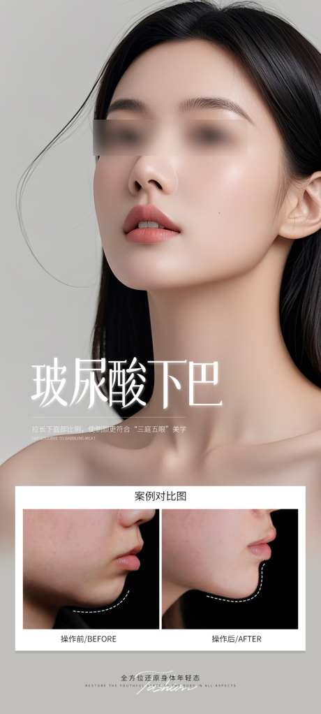 玻尿酸下巴案例海报_源文件下载_PSD格式_1080X2400像素-填充,下巴,玻尿酸-作品编号:2025062216208192-志设-zs9.com