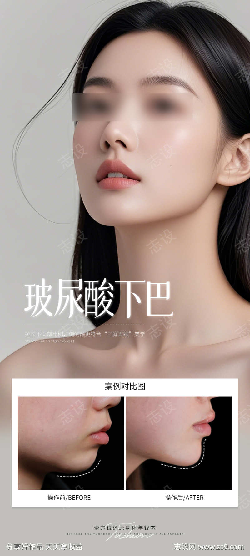 玻尿酸下巴案例海报