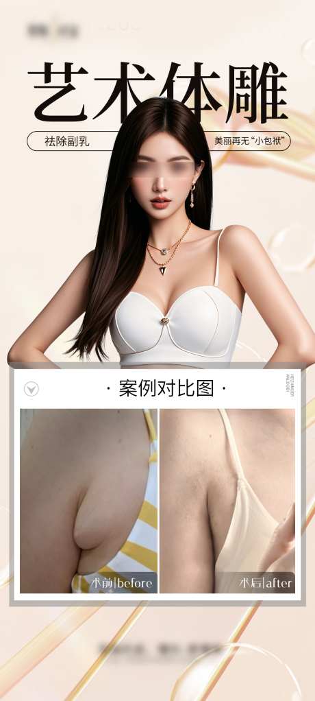 祛除副乳案例海报_源文件下载_PSD格式_1080X2400像素-脂雕,体雕,副乳-作品编号:2025062409331363-志设-zs9.com